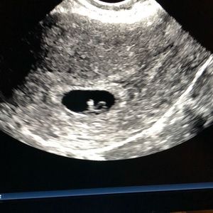 Meet your Posher, Zaire